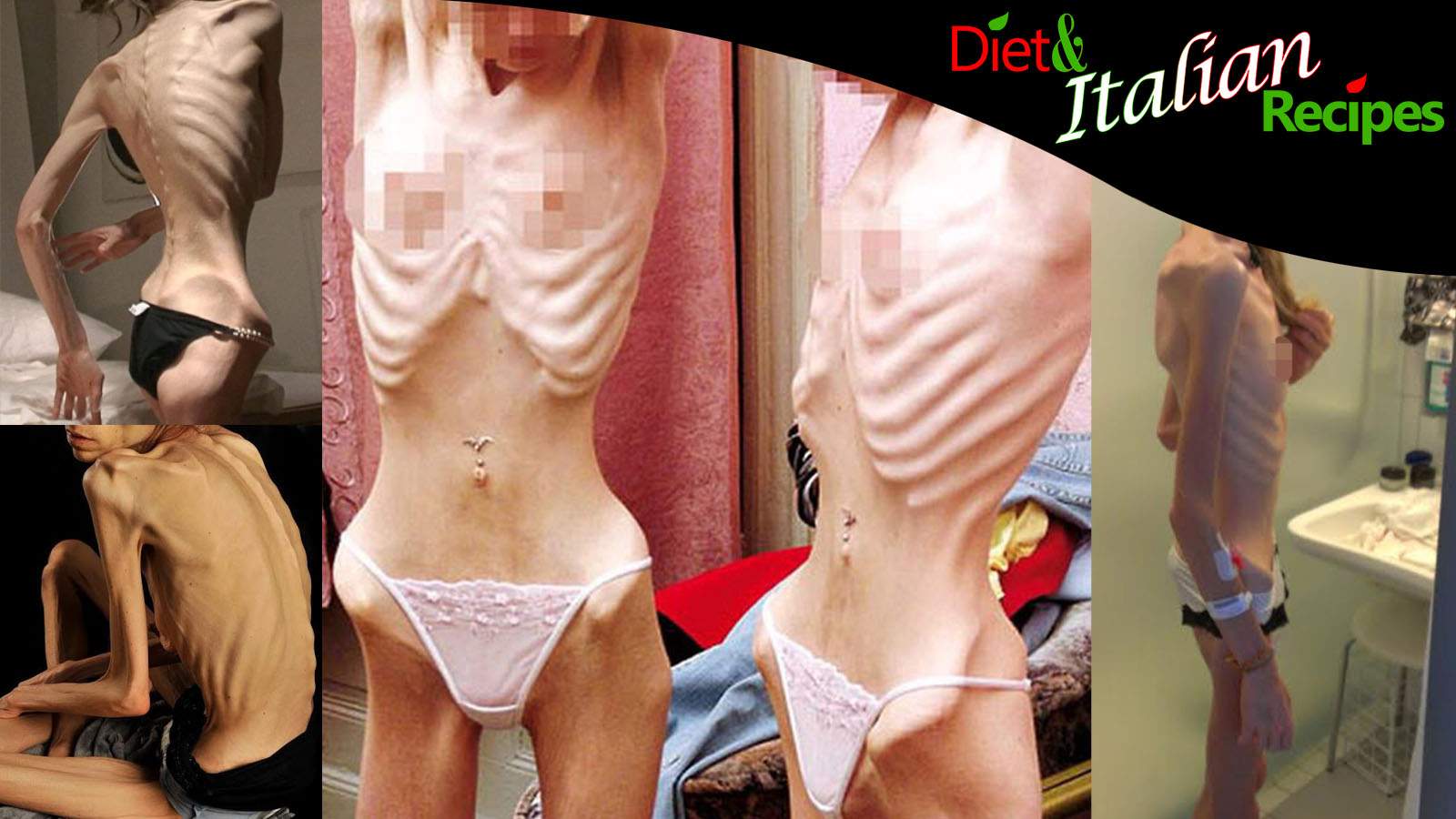 anorexic women consequences images